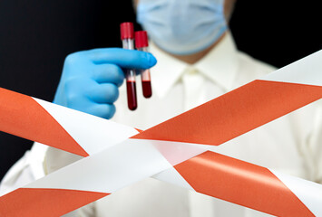 Secret biological weapons against humans, epidemic concept