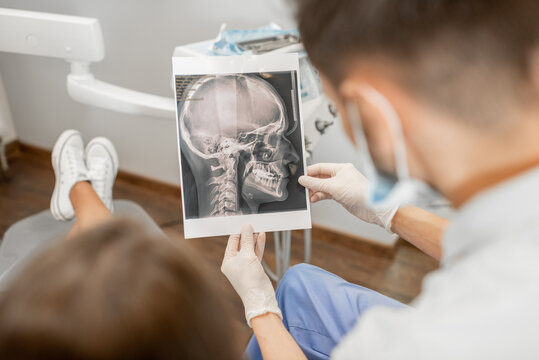 Dentist showing skull x-ray for a young patient during an orthodontic treatment. Girl having a consultation with an orthodontist. High quality photo