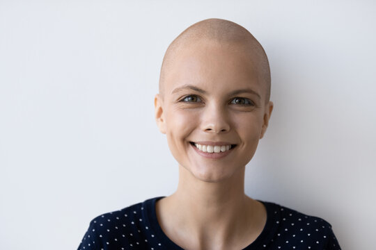 Crop close up portrait of smiling hairless millennial Caucasian woman with oncology feel optimistic. Happy young bald female cancer patient pleasured with good results. Remission, recovery concept.