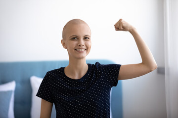 Headshot portrait of smiling young Caucasian hairless woman sick with cancer show power strength...