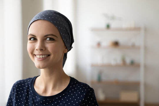 Close Up Portrait Of Smiling Young Caucasian Woman Struggle With Oncology Wear Scarf On Bald Hairless Head. Happy Millennial Female Cancer Patient Feel Optimistic, Hope For Recovery Or Remission.