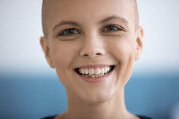 Crop close up portrait of smiling young Caucasian female cancer patient feel optimistic overjoyed...