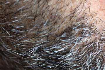 Close-up of an unshaven male face. Selective close-up macro photography with a blurry background