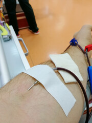 close-up of a needle in a blood donor's vein. The blood goes through the tube. The concept of...