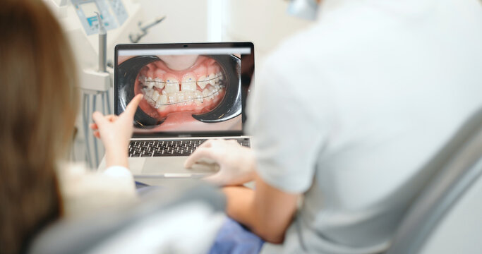 Dentist showing photo of teeth on a laptop for a young patient during an orthodontic treatment. Orthodontic treatment with the help of braces. 4k video screenshot, please use in small size