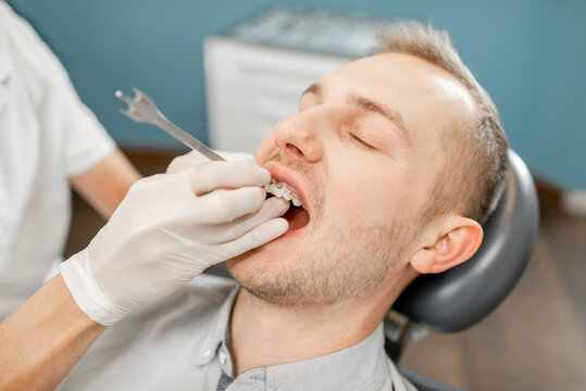 Dentist adjusting dental braces during orthodontic treatment for the young male patient. Close up. High quality photo