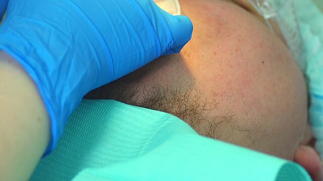 a dentist in a dental clinic with anesthesia fills a diseased tooth and pulpitis on the dental nerve, and also cleans teeth from plaque and caries