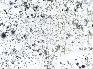Orange mold spores under the light microscope, uncolored mold sample