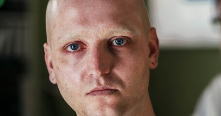 Determined bald man in oncology clinic