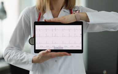 Doctors hands are holding digital tablet with electrocardiogram closeup
