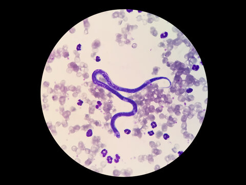 Microfilariae are not sheathed in the blood smear of a dog. Light  microscope of heartworms, Dirofilaria immitis. Stock Photo | Adobe Stock