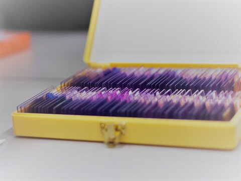 Closed up of microscope glass slide in a box for scientist diagnosis on white background. Peripheral blood film slides in a box.