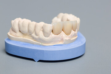 close up of artificial dentition in a dental laboratory ready for use 