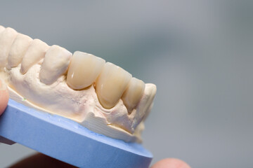 close up of artificial dentition in a dental laboratory ready for use 