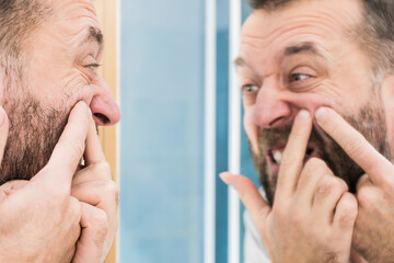 Man looking at pimples on his face