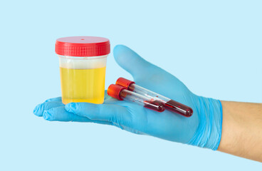 Doctor showing urine and blood samples for medical test