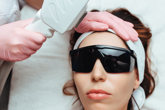 laser facial rejuvenation elos cosmetology