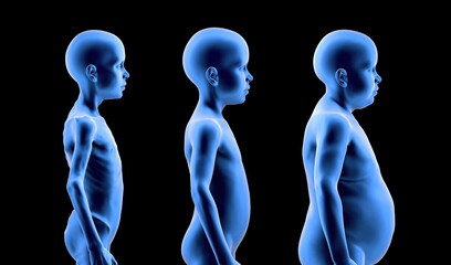 Undernourished child, with normal build and obese child in comparison. Problems of food shortage and obesity in children. 3d render 
