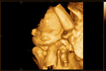  Colourful image of pregnancy ultrasound monitor