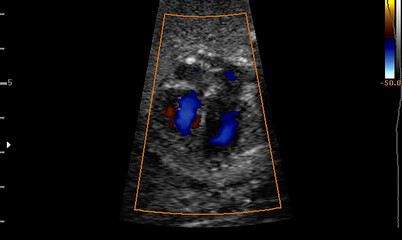 Ultrasound of baby in pregnant woman, Doctor reading test results of pregnant woman by ultrasound.