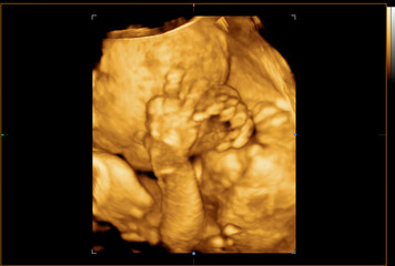  Colourful image of pregnancy ultrasound monitor