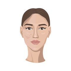 Beauty and freshness of woman face vector illustration. Girl with skin spots, pimples and wrinkles