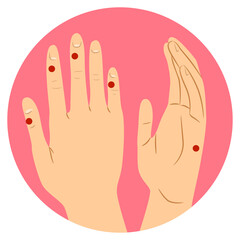Hand Tapping Points Illustration - 412064557