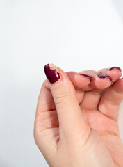 Chipped gel polish coating on the thumb. Close-up. White background.