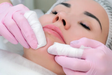 procedure for manual cleansing of the facial skin from blackheads and acne.