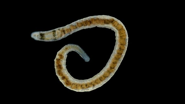 Ophidonais serpentina worm under a microscope, Oligochaeta Subclass, Naididae Family. Sample found in the Volga River
