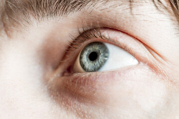 Light gray-blue eye looks up. Close-up