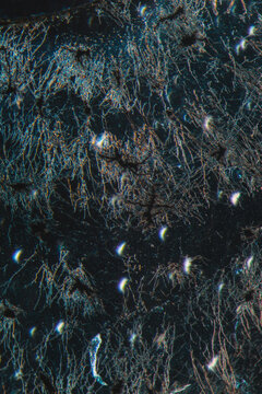 nerve cells