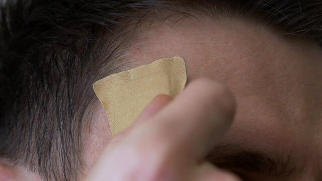 Injured man head with dry blood. Medical Treatment of wounds. Close-up. Take off antiseptic band-aid plaster.
