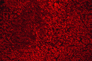 chronic obstruction of human liver