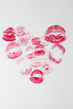 Kiss