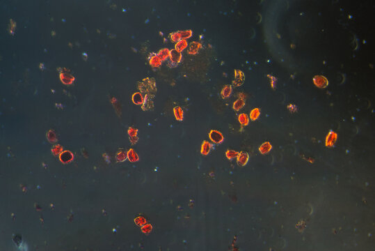 eggs of blood flukes, micrograph.