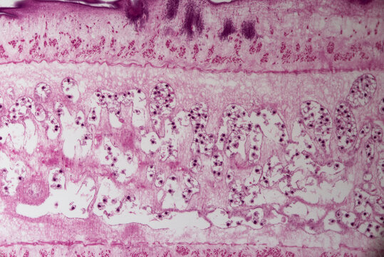 Tapeworm, Taenia Pisiformism
