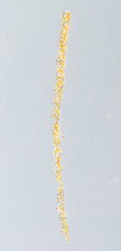 Plasmodesmata of cells