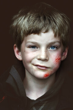 Tough wounded kid after falling off his bike