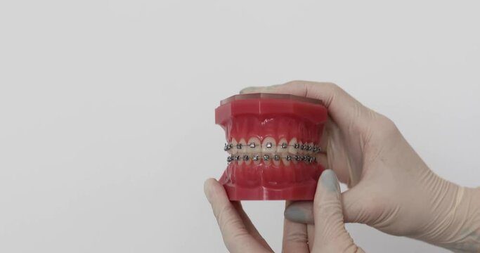 Movement of a dental prosthesis with brackets. Doctor orthodontist closes and opens the plaster casts of the jaw, the chewing apparatus of the person.Dental prosthesis chewing.