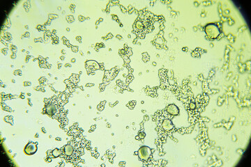 Fototapeta na wymiar Mold spores under the light microscope, orange peel mold, magnification 400 times