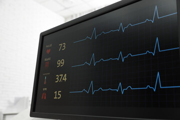 Black monitor with cardiogram in hospital, closeup