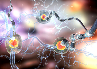 3d illustration of nerve cells, neurons, concept for Neurological Diseases, tumors and brain surgery.  


