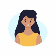 The woman suffers from a problem with the skin of the face and acne. Vector illustration on the topic of cosmetology and dermatology. Health and medicine. Skin care.