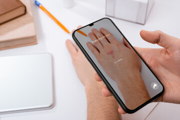 Man using a phone app to recognize skin problems on his hand
