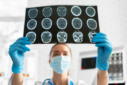 Woman Doctor Examines Head Mri Scan In Hospital