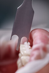 Dental height gauge. Macro photography. Vertical close-up snaphot of a dental measuring tool, teeth...