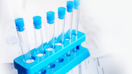 Test tubes on a blue stand against a background of blurred sheets with test results. Chemical laboratories concept.