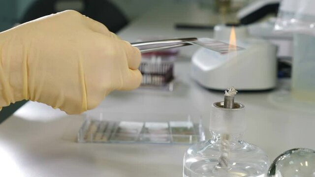 Medicine and microbiology. Glass alcohol burner on table in laboratory. Heated tubes and flasks. Fire and ampoule with medicine. Research laboratory. Bacteriological culture. 4 k video