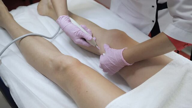 Hands of doctor wiping cotton pads patient's leg preparing to carboxytherapy procedure, body closeup. Doctor prepares leg for injection of carbon dioxide. Treatment of skin tags and stretches